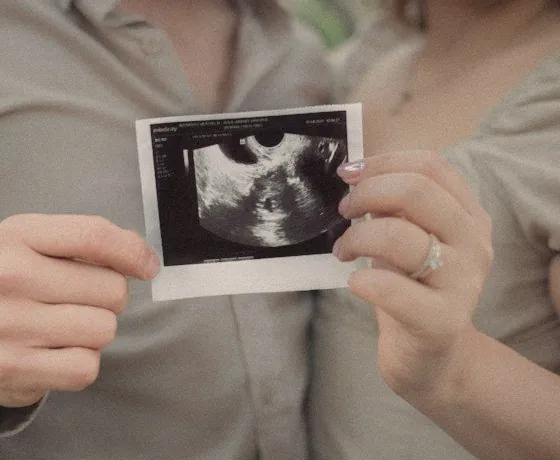 Hands holding the 20-week ultrasound print